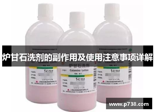 炉甘石洗剂的副作用及使用注意事项详解